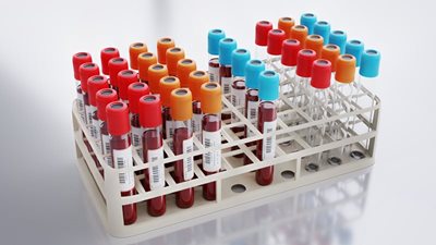 blood-collection-6574436.jpg