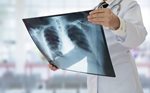 Temps d'attente actuel pour les examens radiologiques