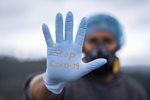 St. Nikolaus-Hospital muss wegen neuer staatlicher  Covid-Vorgaben Eingriffe reduzieren und einstellen