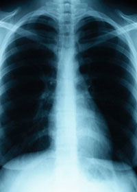 Pneumologie