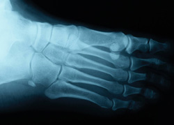 Orthopädie